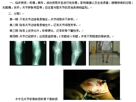 【骨科】关节镜术结合中医分期治疗膝关节骨性关节炎(一)