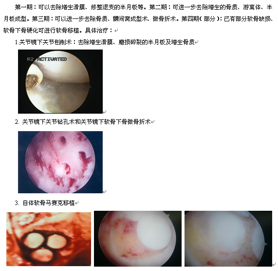 【骨科】关节镜术结合中医分期治疗膝关节骨性关节炎(二)