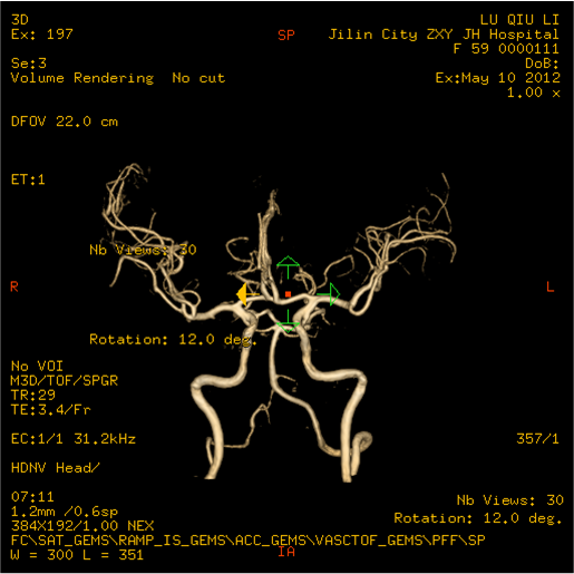 美国GE3.0磁共振