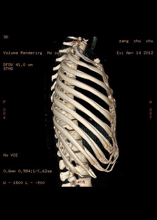 美国GE宝石能谱CT
