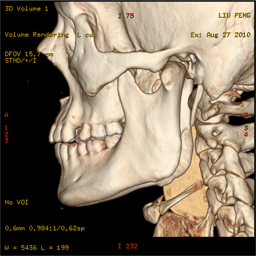 美国GE宝石能谱CT
